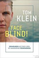 Tom Klein Face Blind!