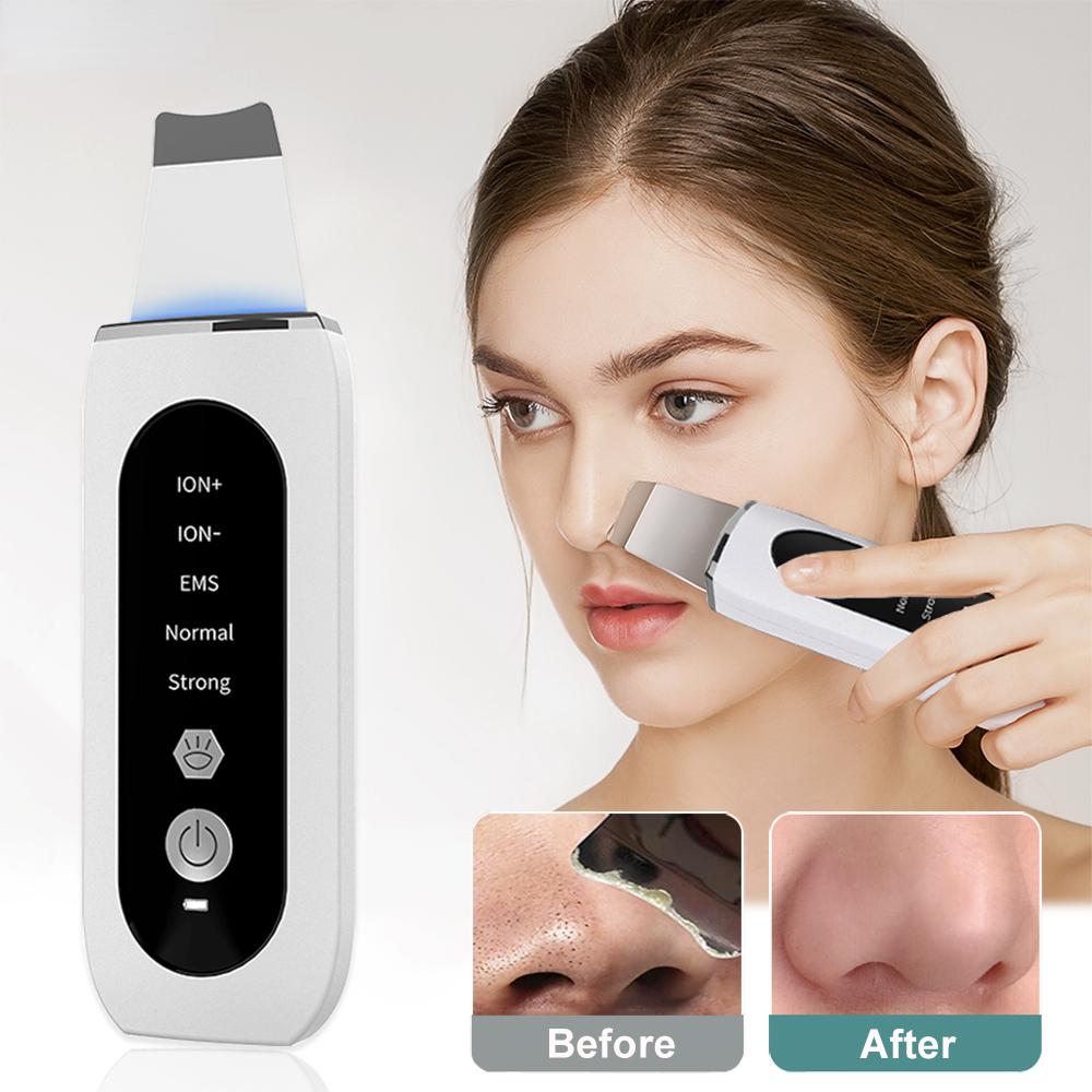 Happy World Electronics Ultrasone huidscrubber Peeling Comedondrukker Diepe gezichtsreiniging Ultrasone Ion Ance Pore Cleaner Facial Schop Cleanser wit