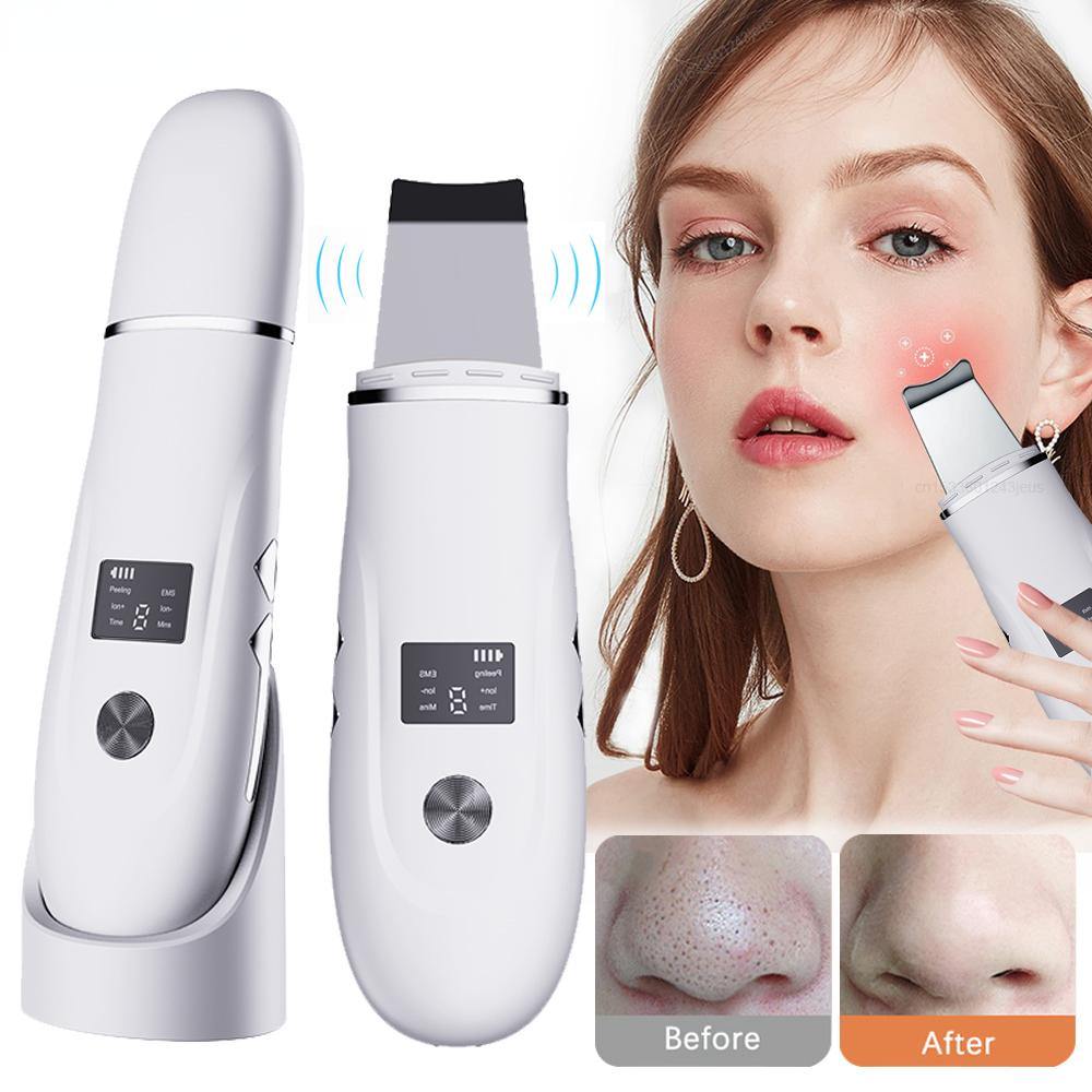 Happy World Electronics Ultrasone Huid Scrubber Comedondrukker Ultrasone Peeling Porie Schoner Gezicht Reiniging Scrubber Ultrasone Gezichtsspatel wit