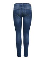 Only Skinny fit jeans met ritsdetails, model 'Kendell'