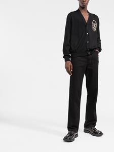 Alexander McQueen Vest verfraaid met doodskop patch - Zwart