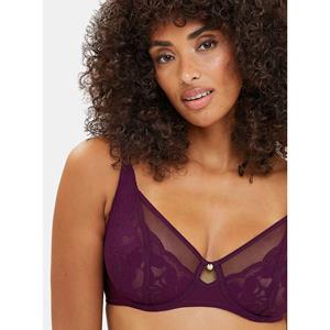 Sans complexe BH met beugels Romance